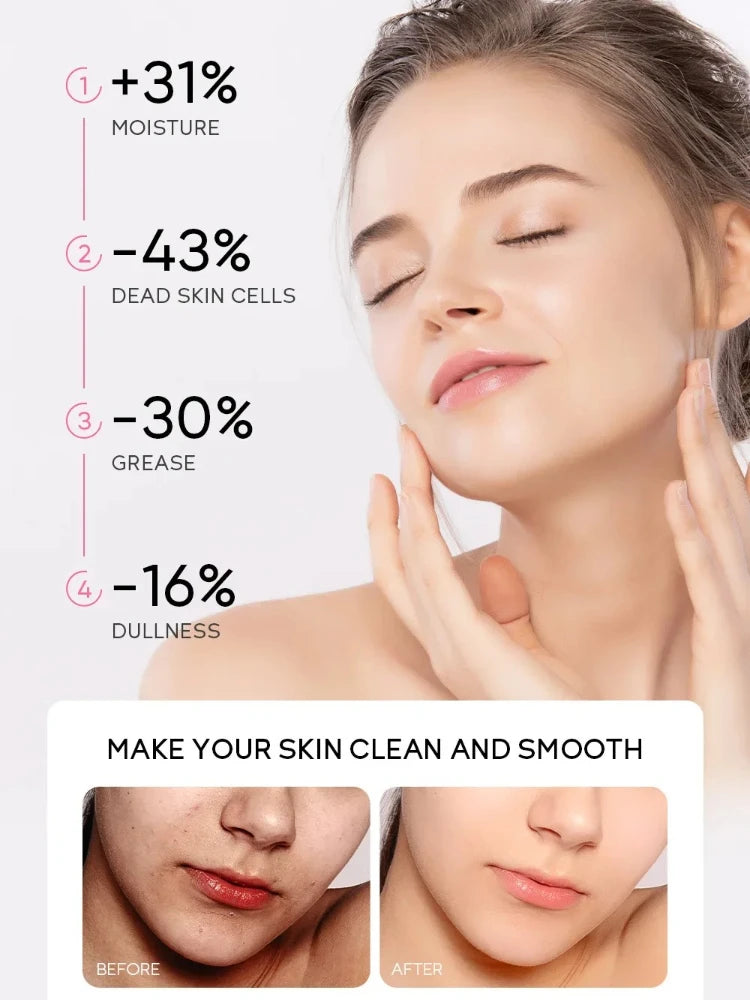 Sakura Exfoliating Peeling Gel – Gentle 3-Minute Facial Exfoliator
