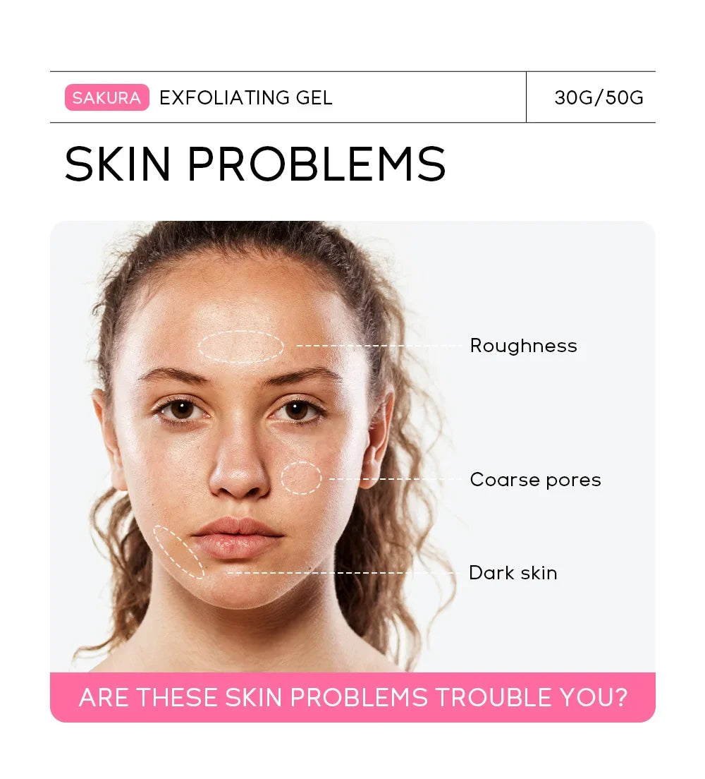Sakura Exfoliating Peeling Gel – Gentle 3-Minute Facial Exfoliator