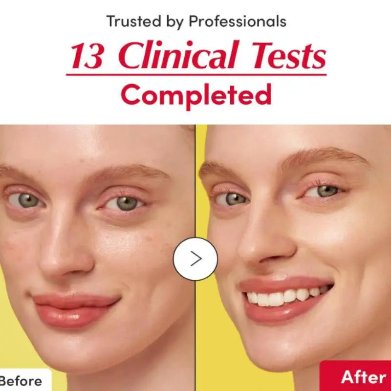 Vitamin C Serum with Niacinamide – Brightening Face Serum